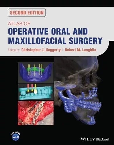 Atlas of Operative Oral and Maxillofacial Surgery (2nd Edition) – PDF